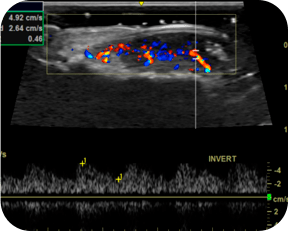 Ultrassom com Doppler