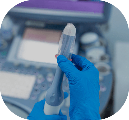 Ultrassom transvaginal