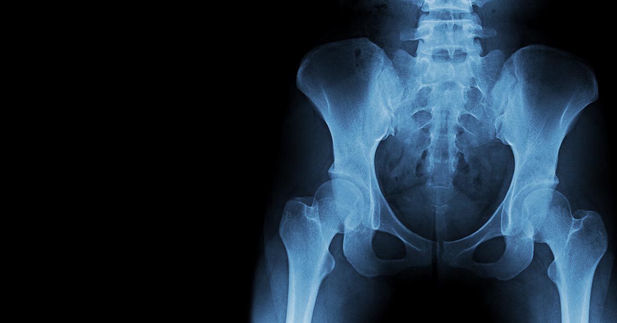 Comparação de Métodos de Imagem: Radiologia em Foco