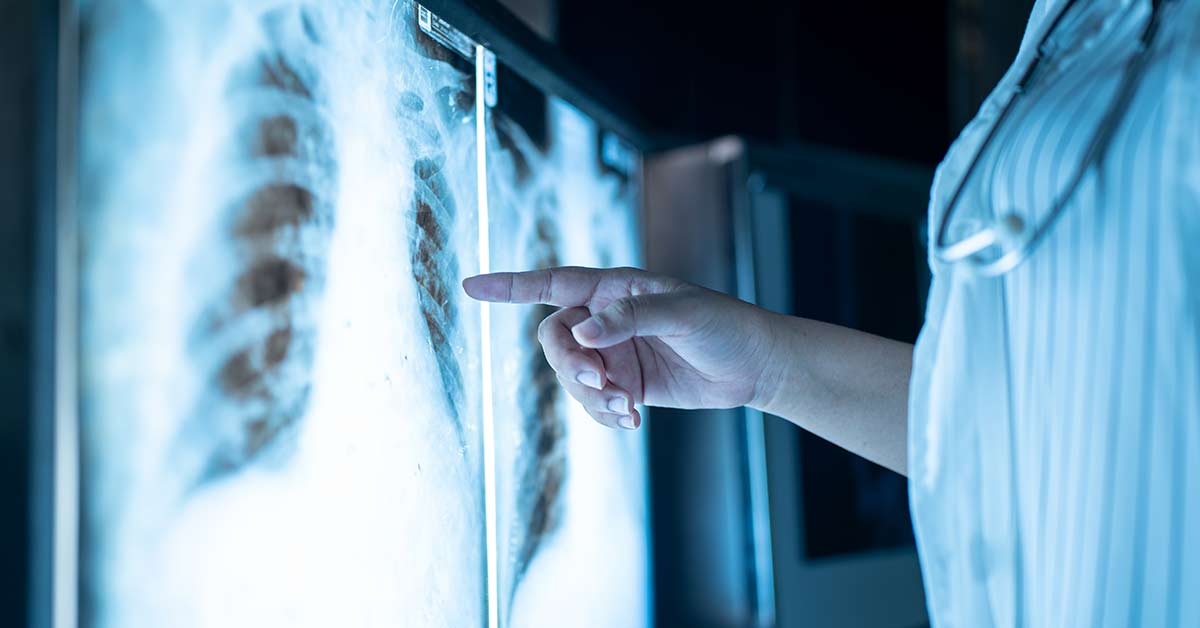 Como a Radiologia Melhora a Eficiência dos Cuidados de Saúde